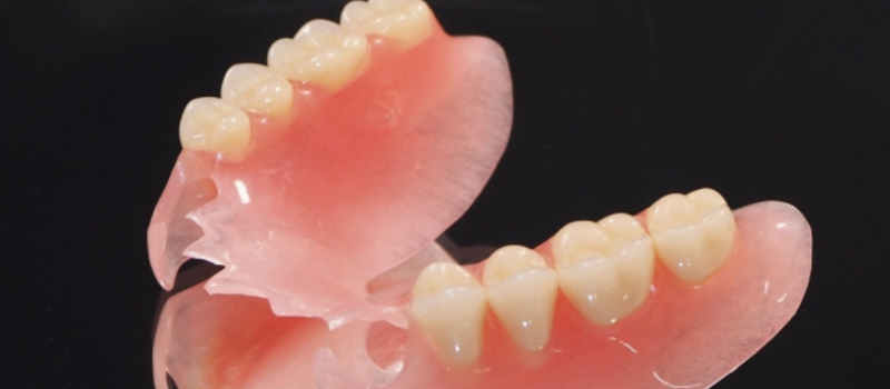 ノンクラスプデンチャーとは